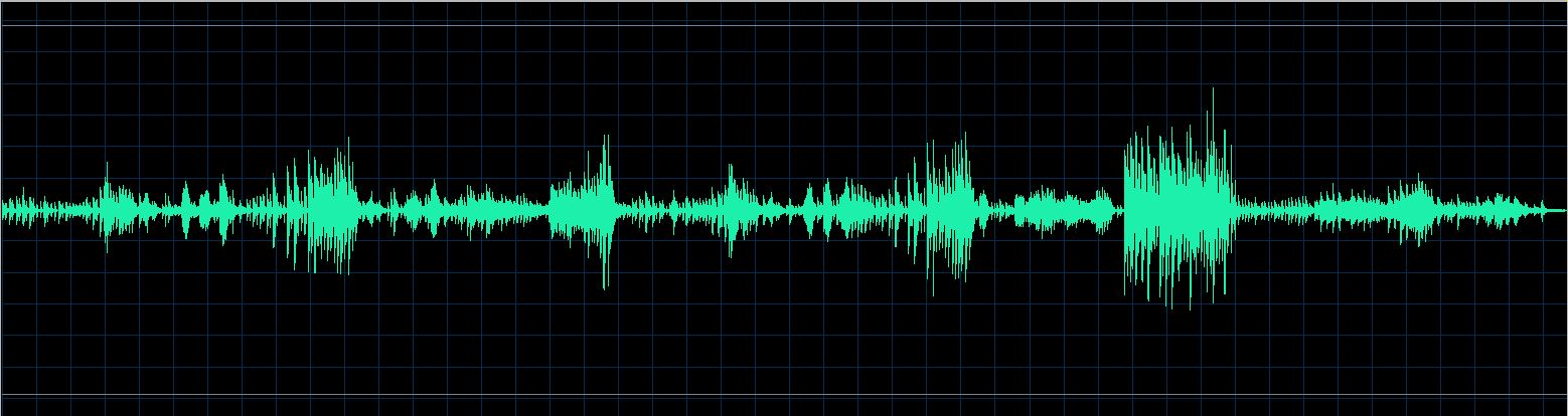 Fischer waveform