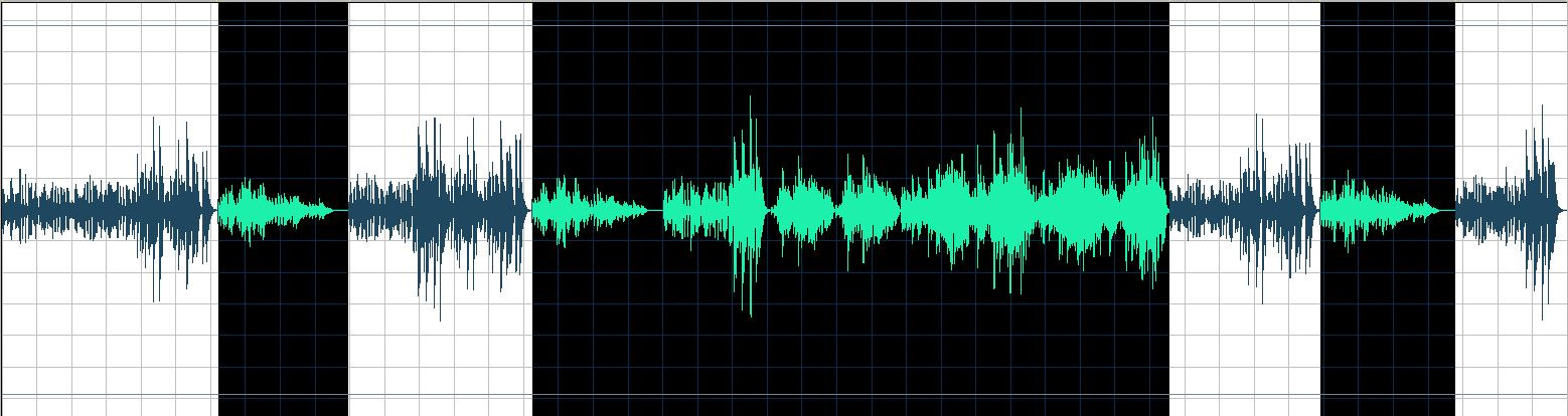 Fischer waveform