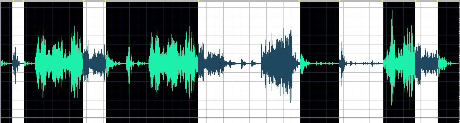 O’Conor waveform