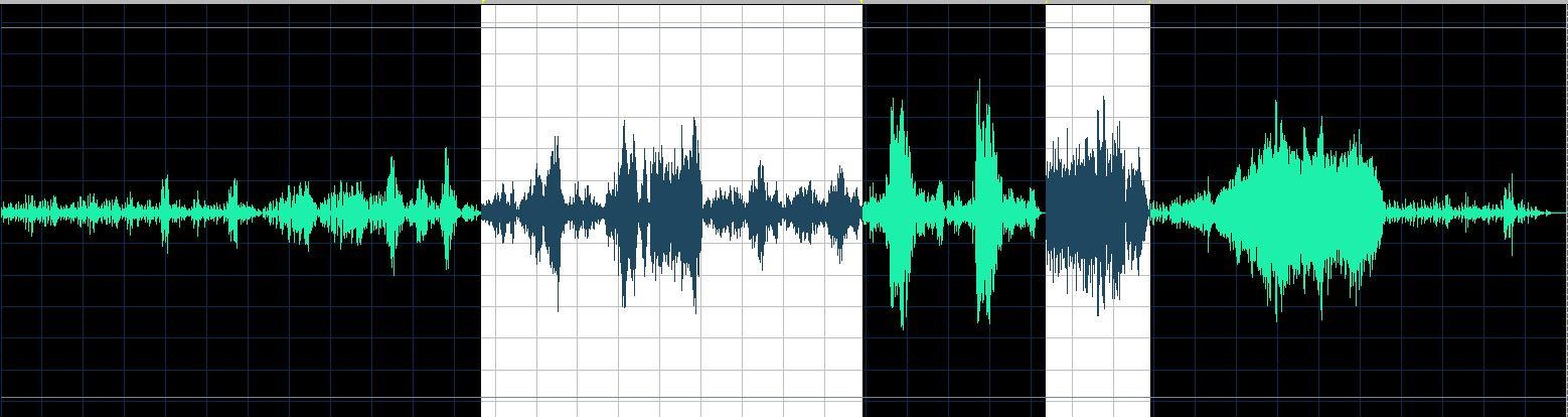 Buchbinder waveform