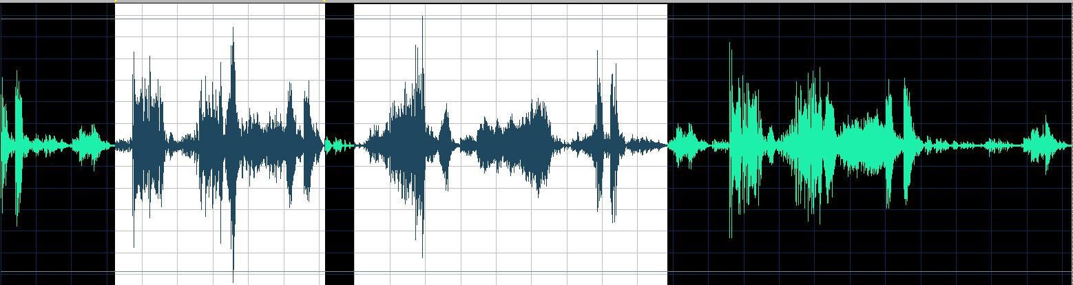 O'Conor waveform