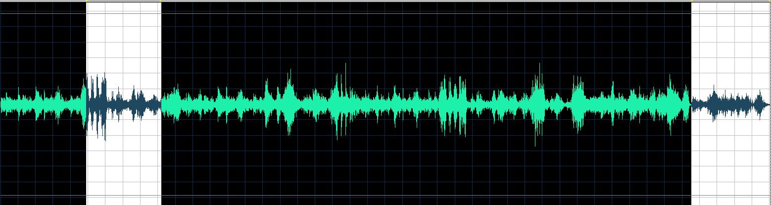 O'Conor waveform