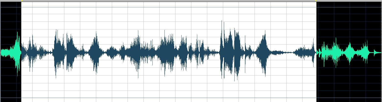 O'Conor waveform