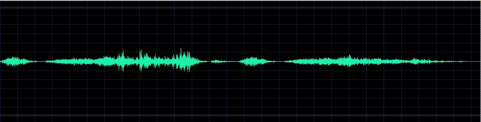 Boukoff waveform