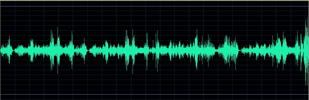 O’Conor waveform