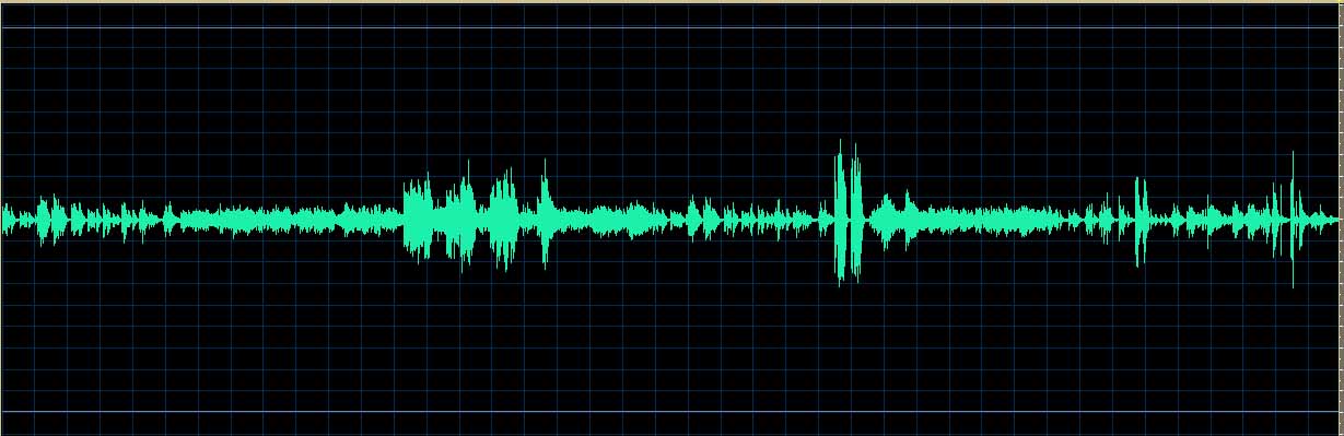 O’Conor waveform