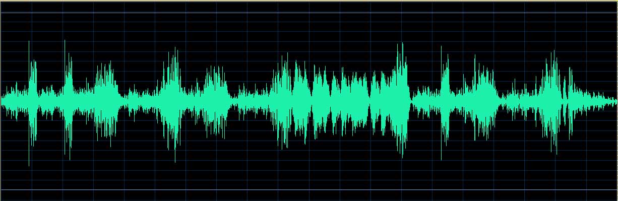 O’Conor waveform