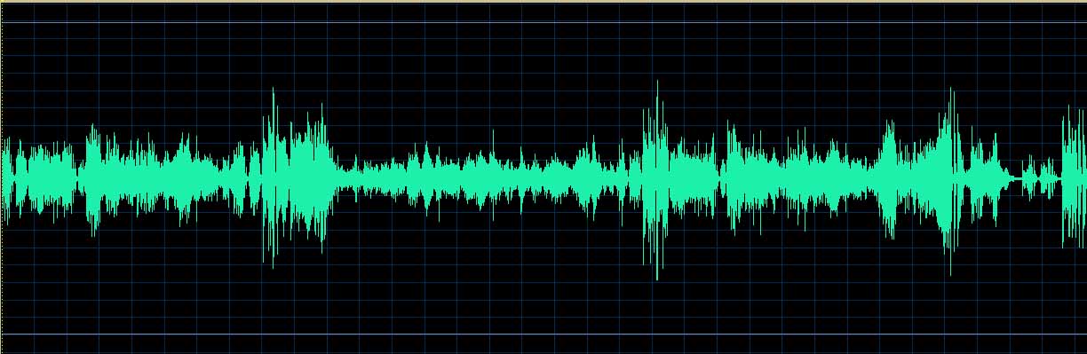 O’Conor waveform