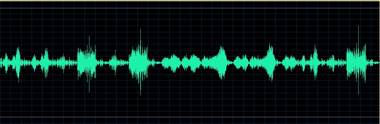O’Conor waveform