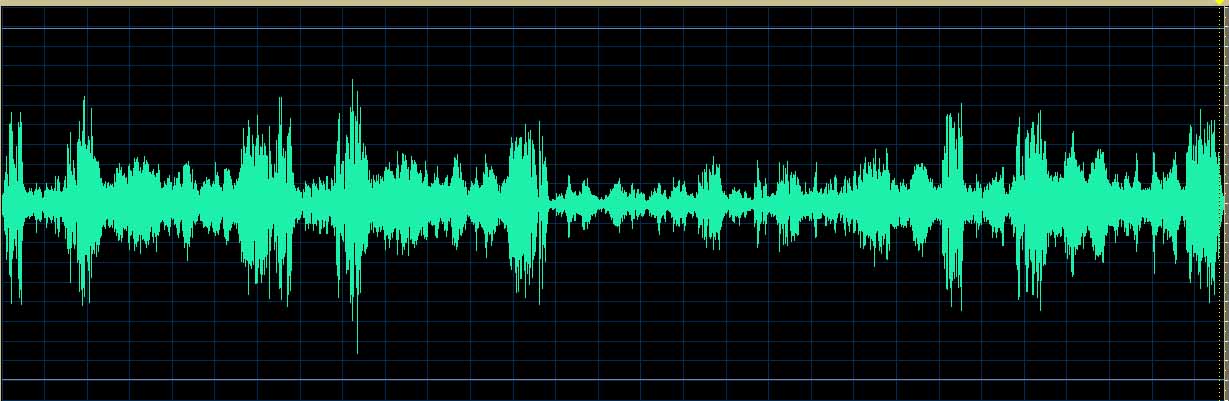 O’Conor waveform