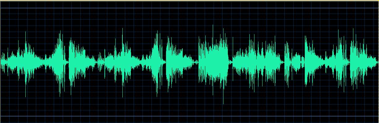 O’Conor waveform