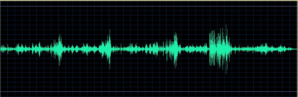 O’Conor waveform