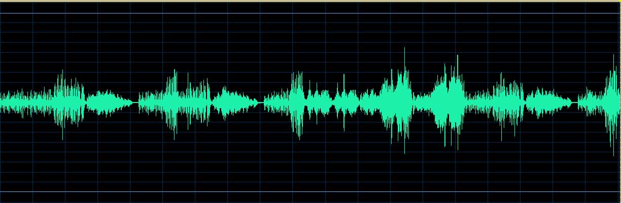 O’Conor waveform