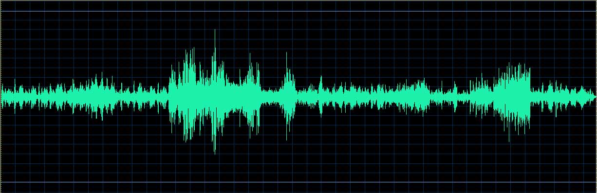 O’Conor waveform