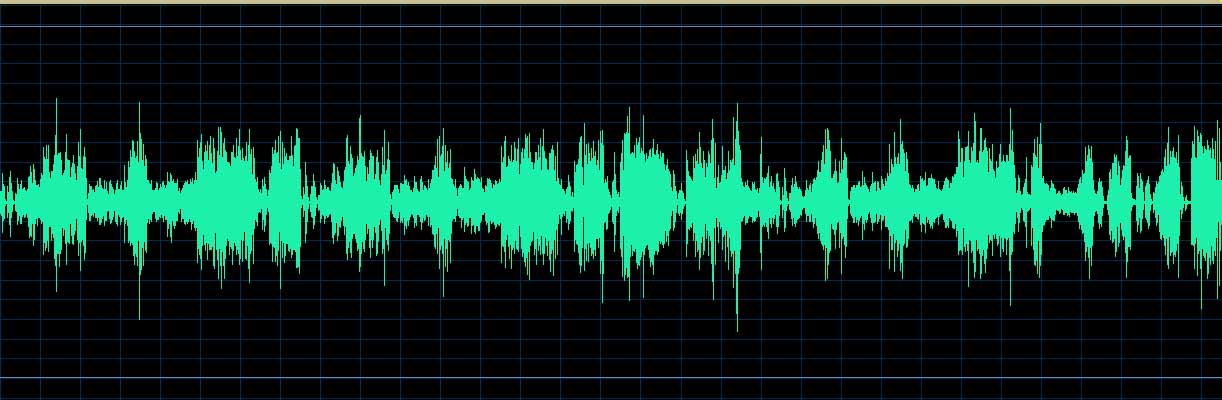 O’Conor waveform