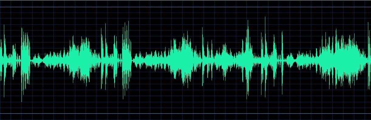 O’Conor waveform