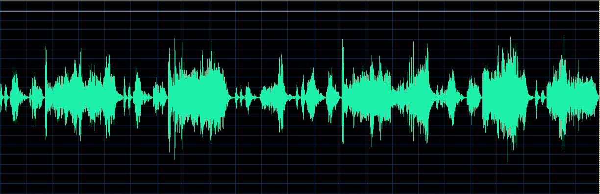 O’Conor waveform