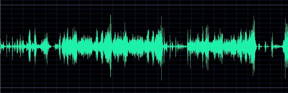 O’Conor waveform