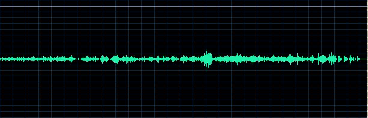 O’Conor waveform