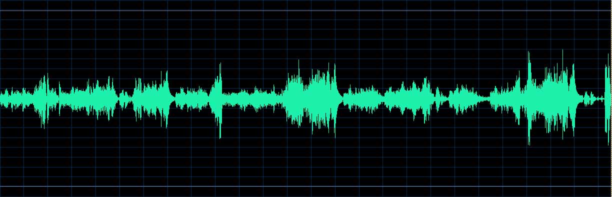 O’Conor waveform