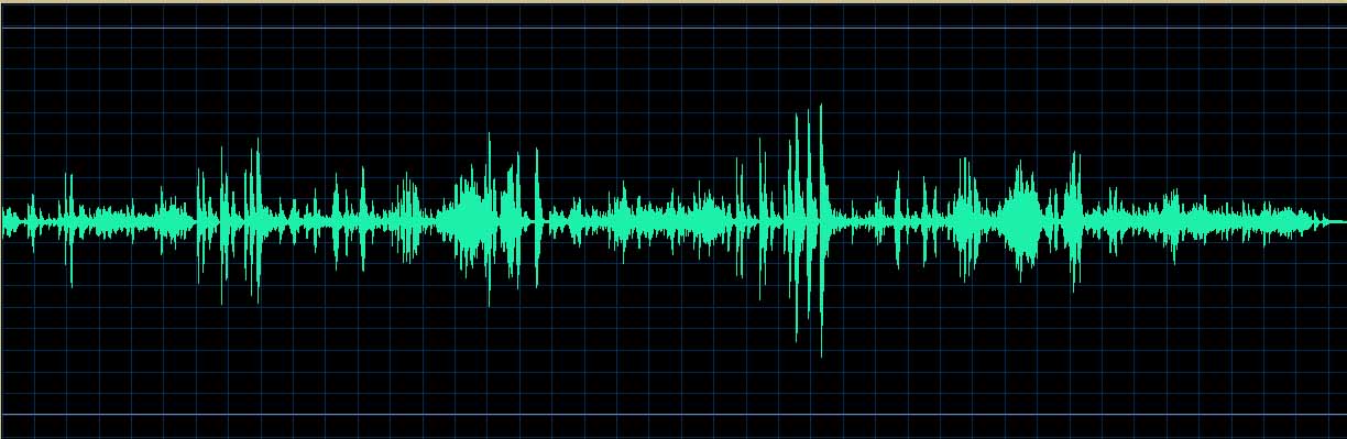 O’Conor waveform