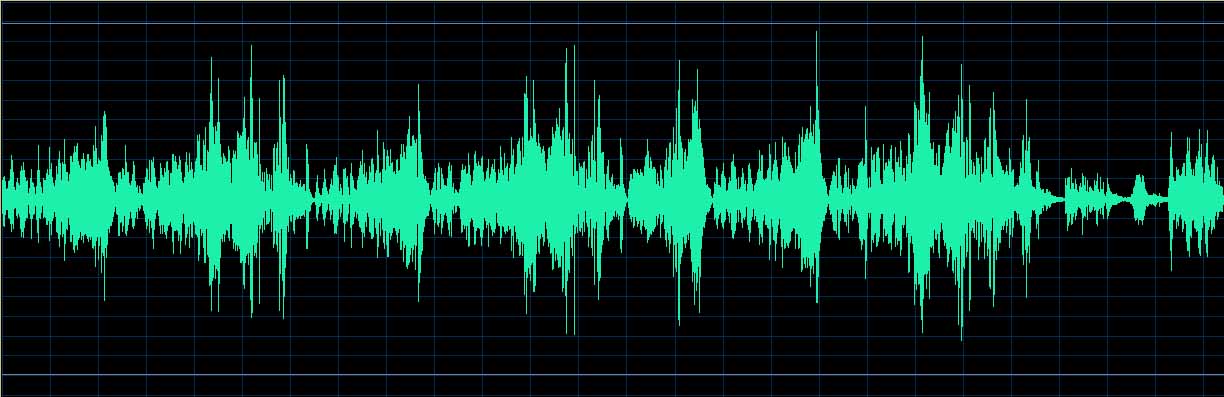 O’Conor waveform