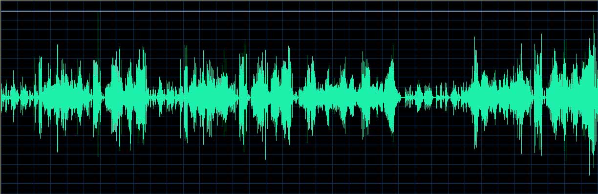 O’Conor waveform