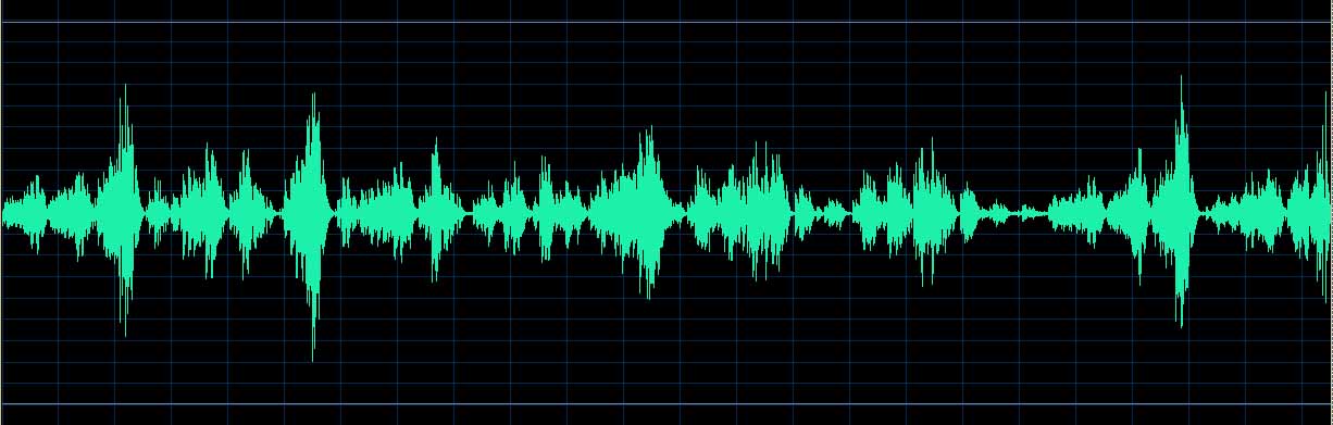 O’Conor waveform
