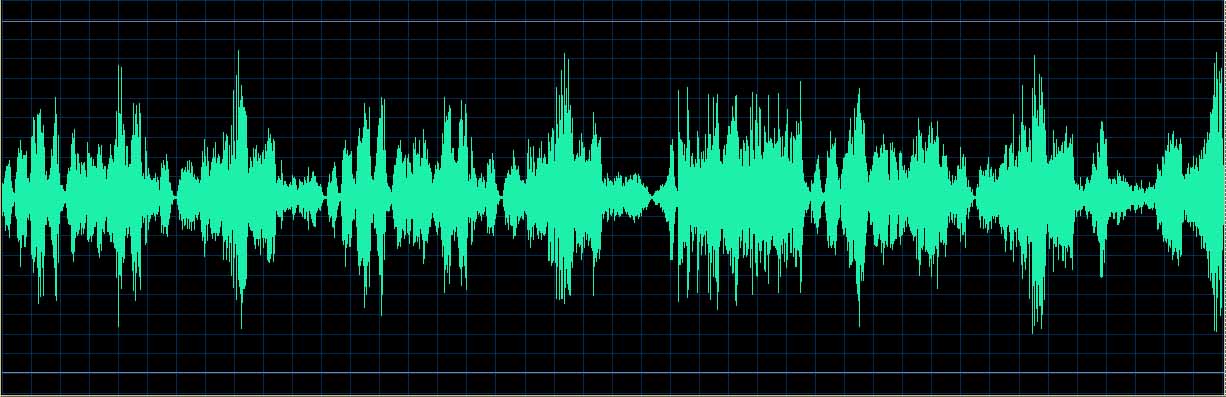 O’Conor waveform
