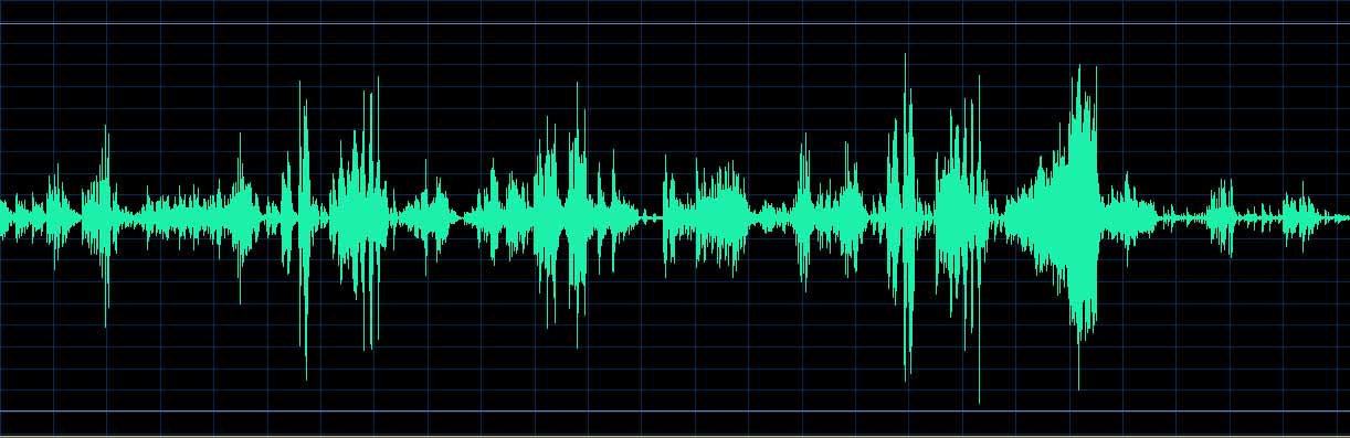 O’Conor waveform