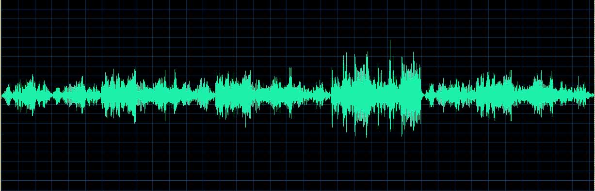 O’Conor waveform
