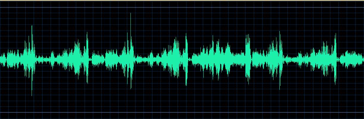O’Conor waveform