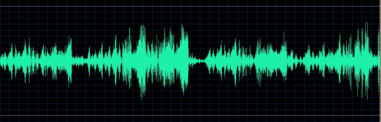 O’Conor waveform