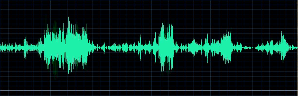 O’Conor waveform