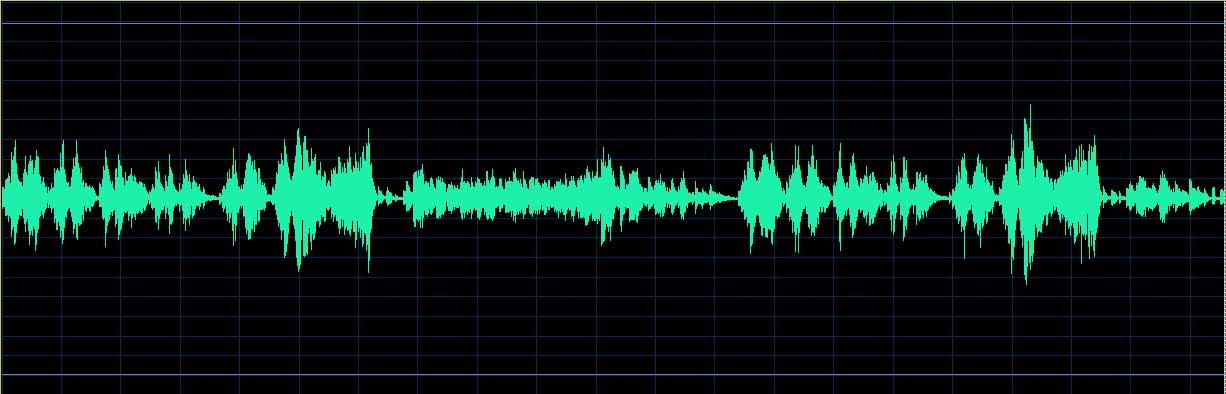 O’Conor waveform