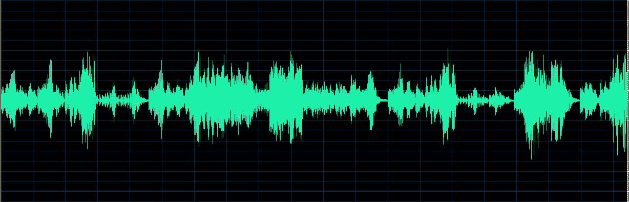 O’Conor waveform