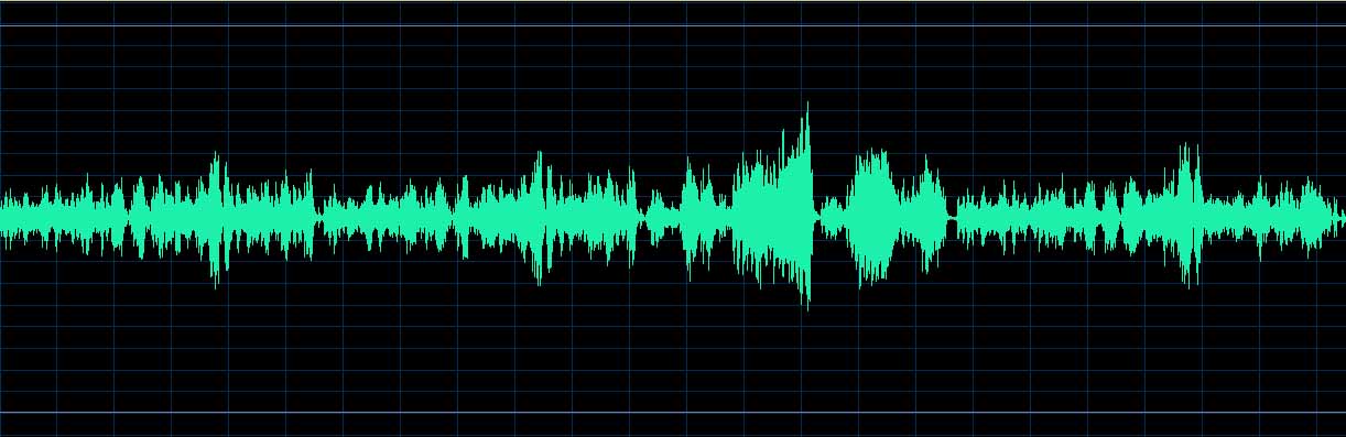O’Conor waveform