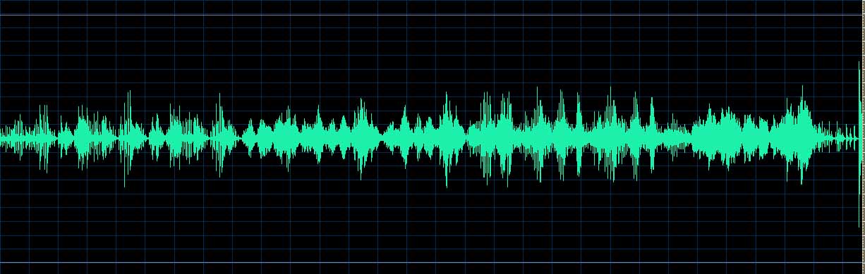 O’Conor waveform