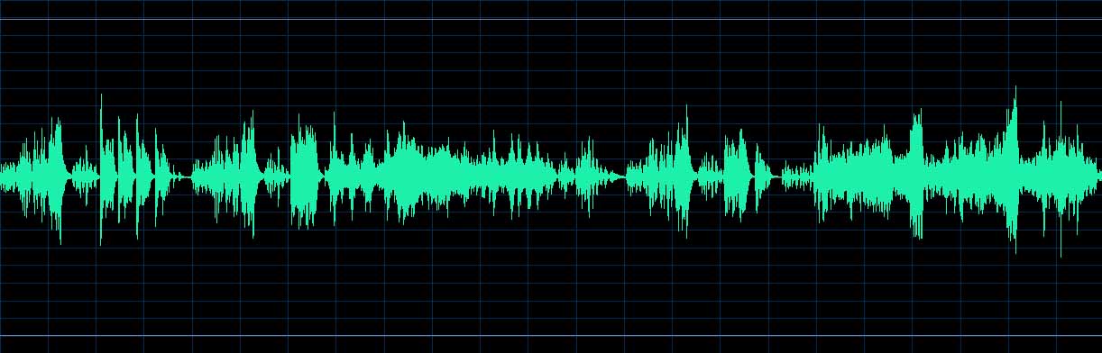 O’Conor waveform