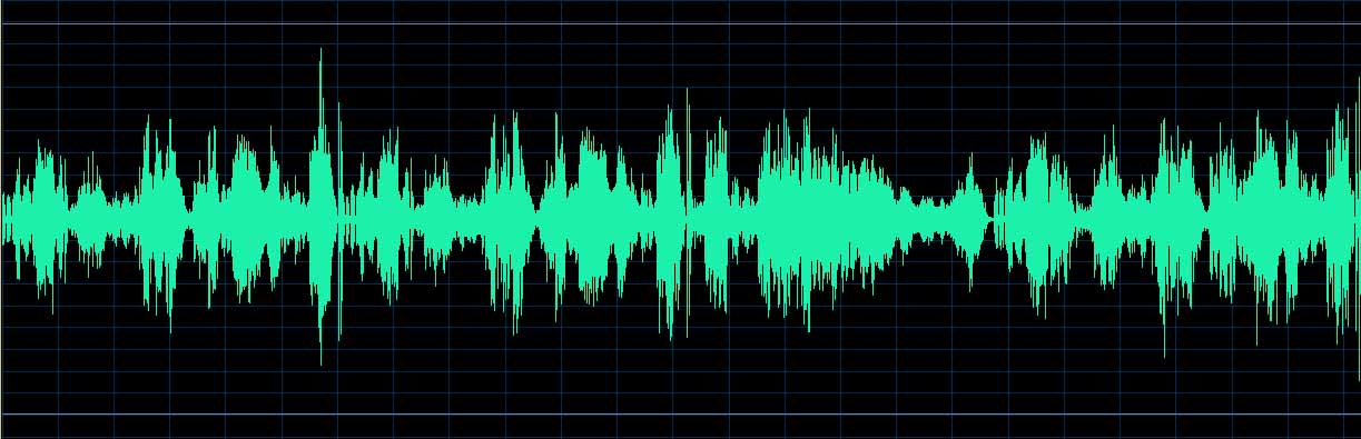 O’Conor waveform
