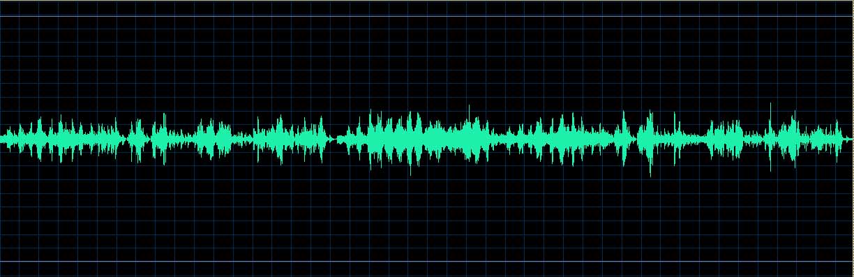 O’Conor waveform