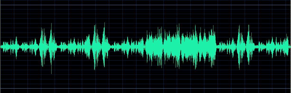 O’Conor waveform