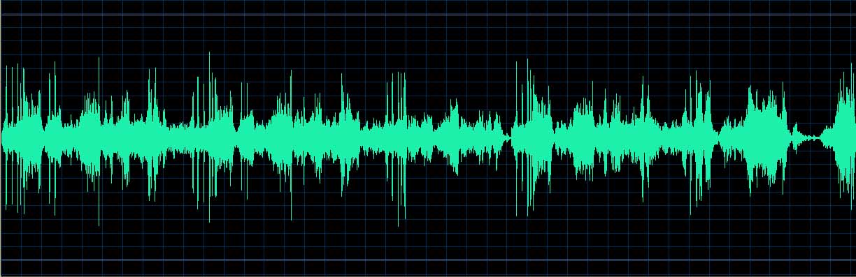 O’Conor waveform