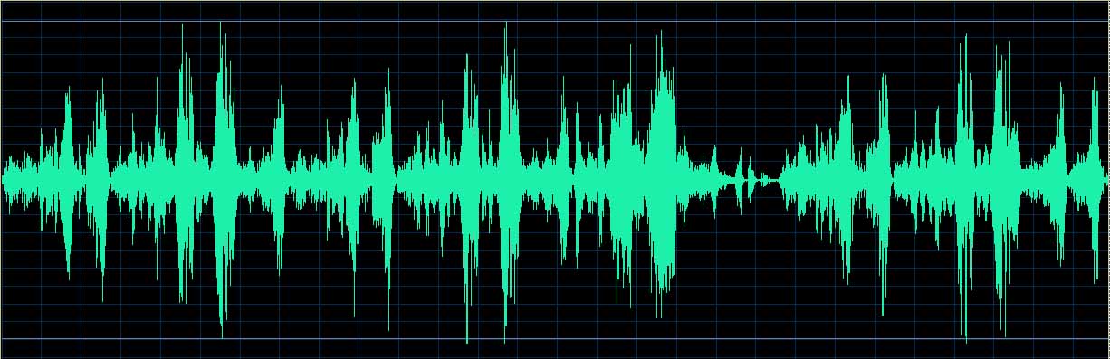 O’Conor waveform