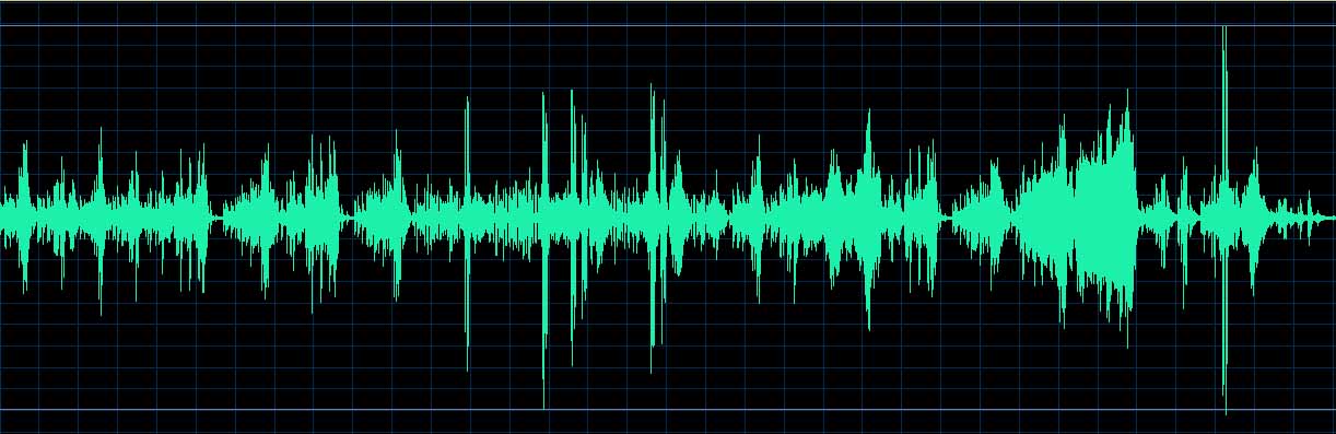 O’Conor waveform