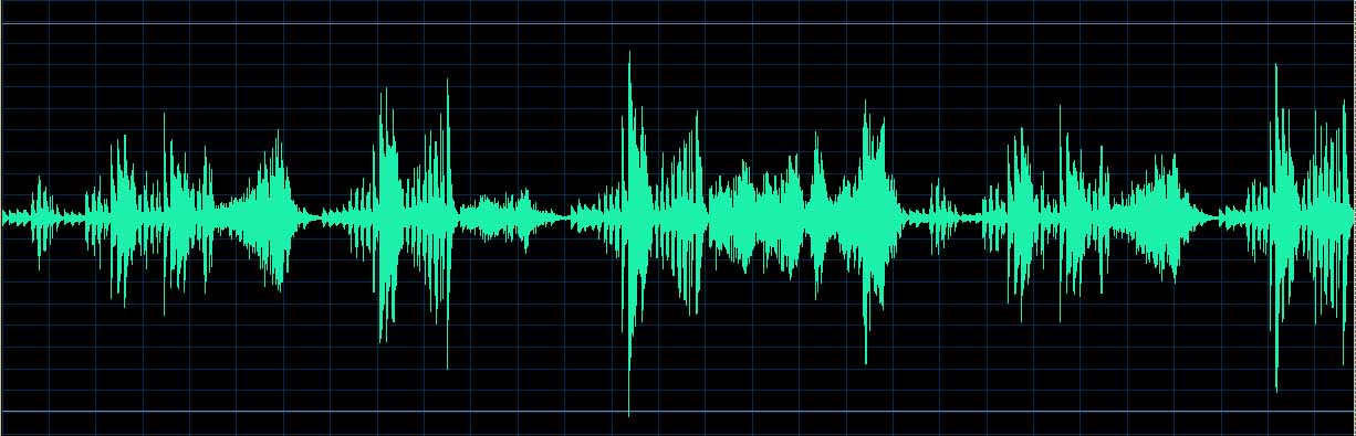 O’Conor waveform