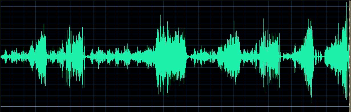 O’Conor waveform