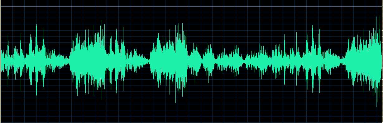 O’Conor waveform