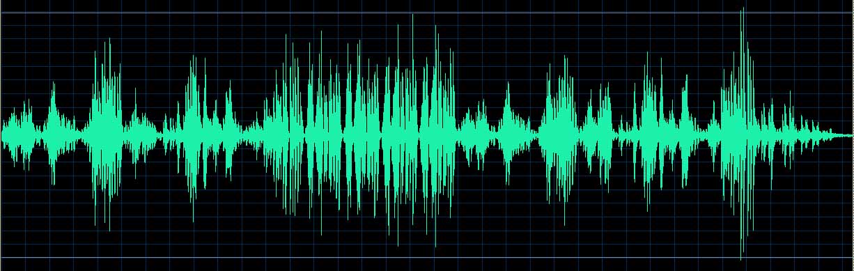 O’Conor waveform