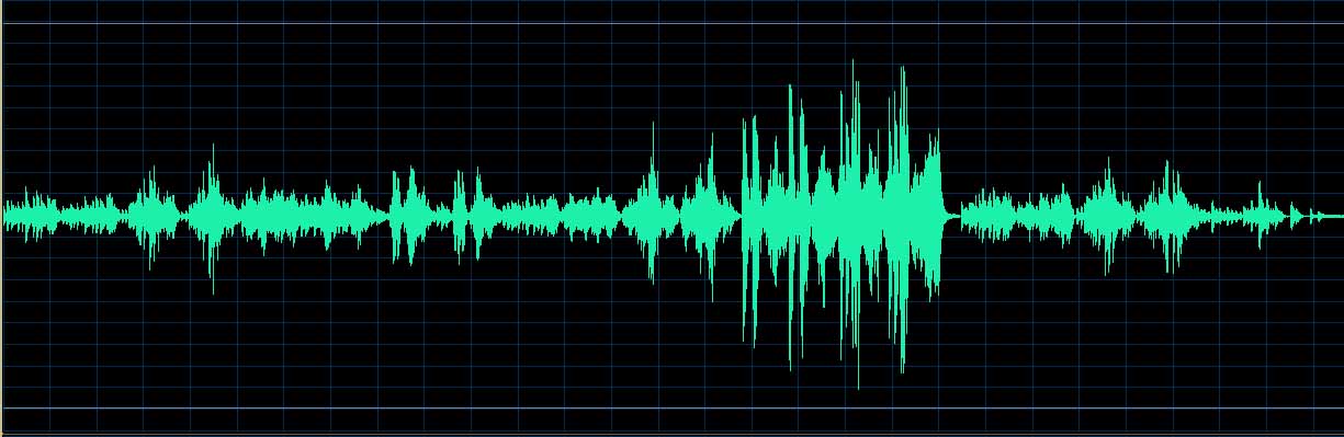 O’Conor waveform
